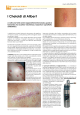 Cheloidi e cicatrici ipertrofiche in dermatologia