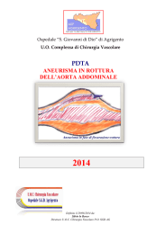 PDTA aneurisma in rottura dell`aorta addominale