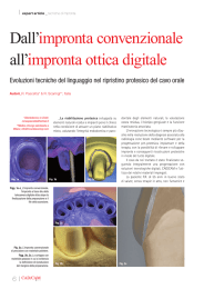 Dall`impronta convenzionale all`impronta ottica digitale