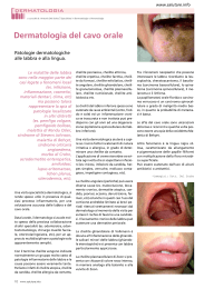 Dermatologia delle labbra e del cavo orale