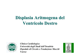 Displasia Aritmogena del ventricolo destro