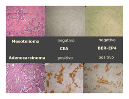 Mesotelioma Adenocarcinoma CEA BER-EP4 negativo