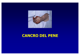 Il Carcinoma del pene