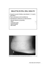 MALATTIA DI STILL DELL`ADULTO