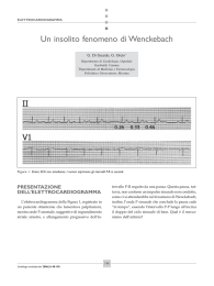 Un insolito fenomeno di Wenckebach