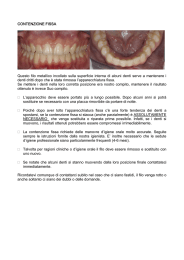 CONTENZIONE FISSA Questo filo metallico incollato sulla superficie