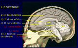 Tronco Cerebrale