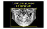 Bifosfonati_1 - Studio Dentistico Monni