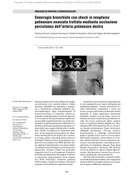 Emorragia bronchiale con shock in neoplasia polmonare avanzata