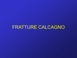 FRATTURE DEL CALCAGNO
