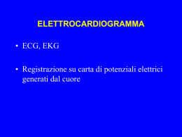 Elettrocardiogramma ST sottolivellato a 80 msec dal punto J