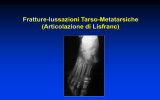 Lussazione della Lisfranc - lerat