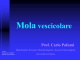 3) Mola Vescicolare