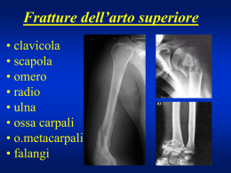 Fratture di clavicola