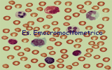 Eritropoiesi (Formazione di GR)