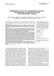 Establishment of four new mesothelioma cell lines: characterization by ultrastructural and