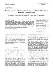 Primary lymphoepithelioma-like carcinoma within an intralobular pulmonary sequestration CASE STUDY N. Hekelaar*