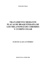 TRATAMIENTO MEDIANTE PLACAS DE BRAQUITERAPIA DE LOS MELANOMAS DE COROIDES Y CUERPO CILIAR