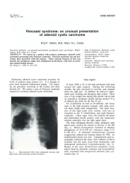 Pancoast  syndrome:  an  unusual  presentation