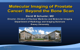 Molecular Imaging of Prostate Cancer: Beyond the Bone Scan