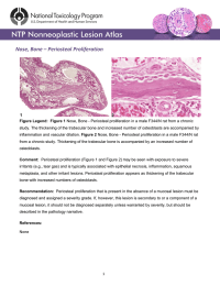 Nose, Bone – Periosteal Proliferation