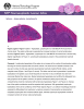 Spleen – Hyperplasia, Lymphocyte