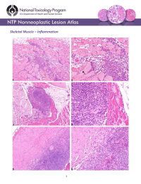 Skeletal Muscle – Inflammation 1