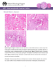 Skeletal Muscle – Necrosis